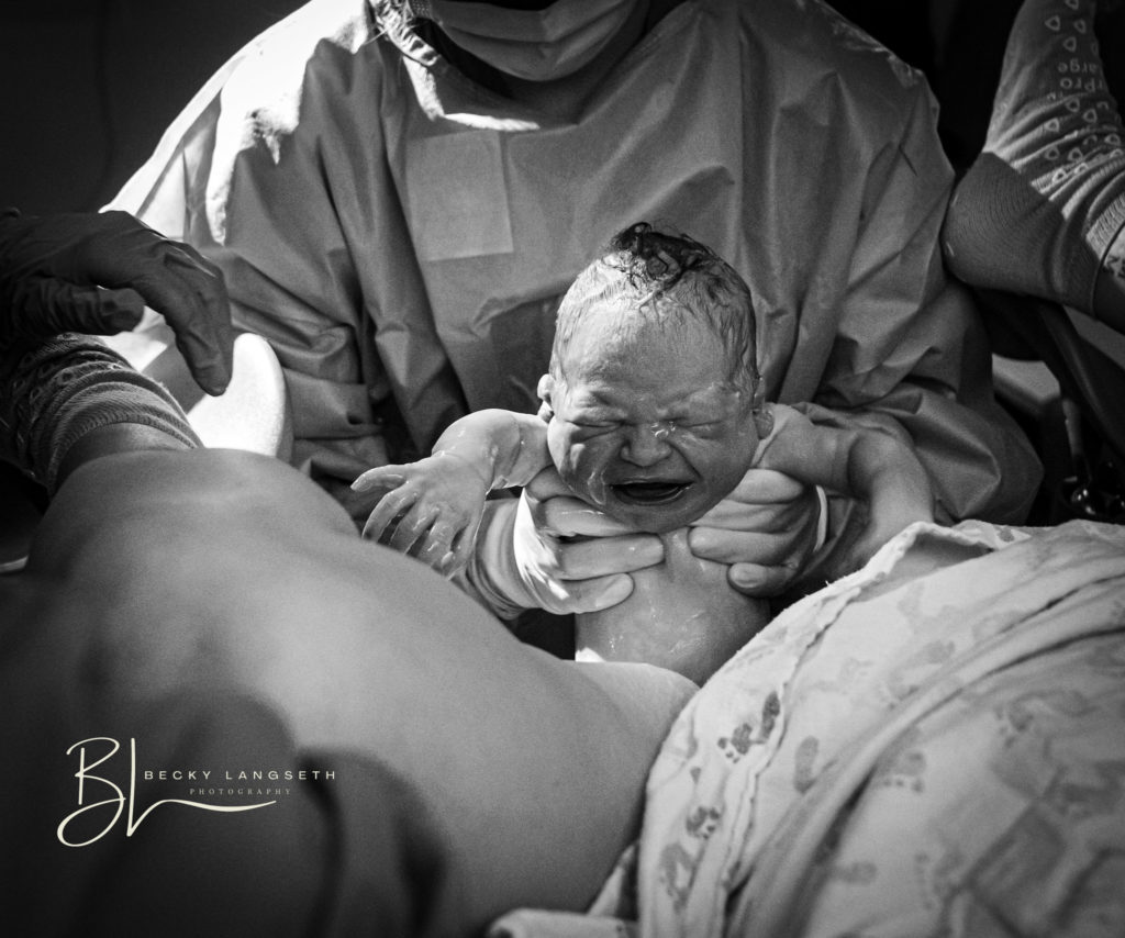 A doctor is pulling a baby out and up onto it's mother's chest. This image is discrete and shows that honest misconceptions about birth photography are only misconceptions, and that birth photography can be discrete, without showing graphic and private parts. 