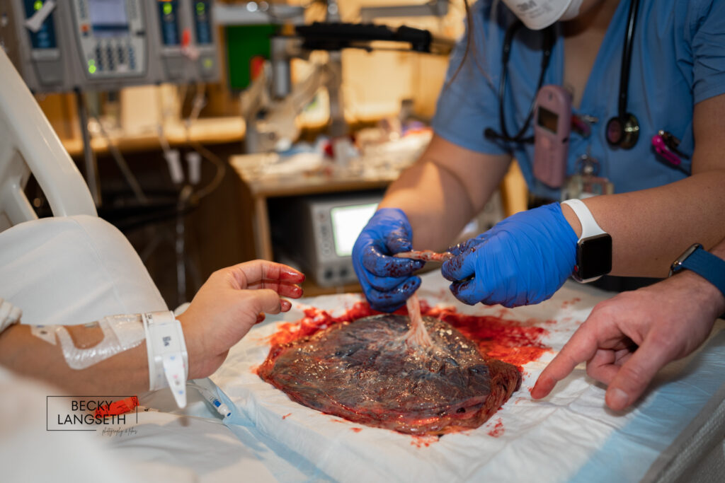 A nurse at UW Medical Center - Montlake, in Seattle, WA is giving some new parents a hands-on placenta tour.