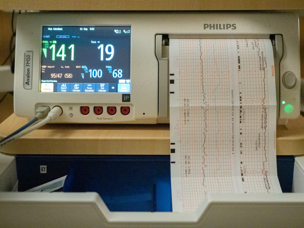A machine monitoring contactions at a birth at Overlake Childbirth Center in Washington State.