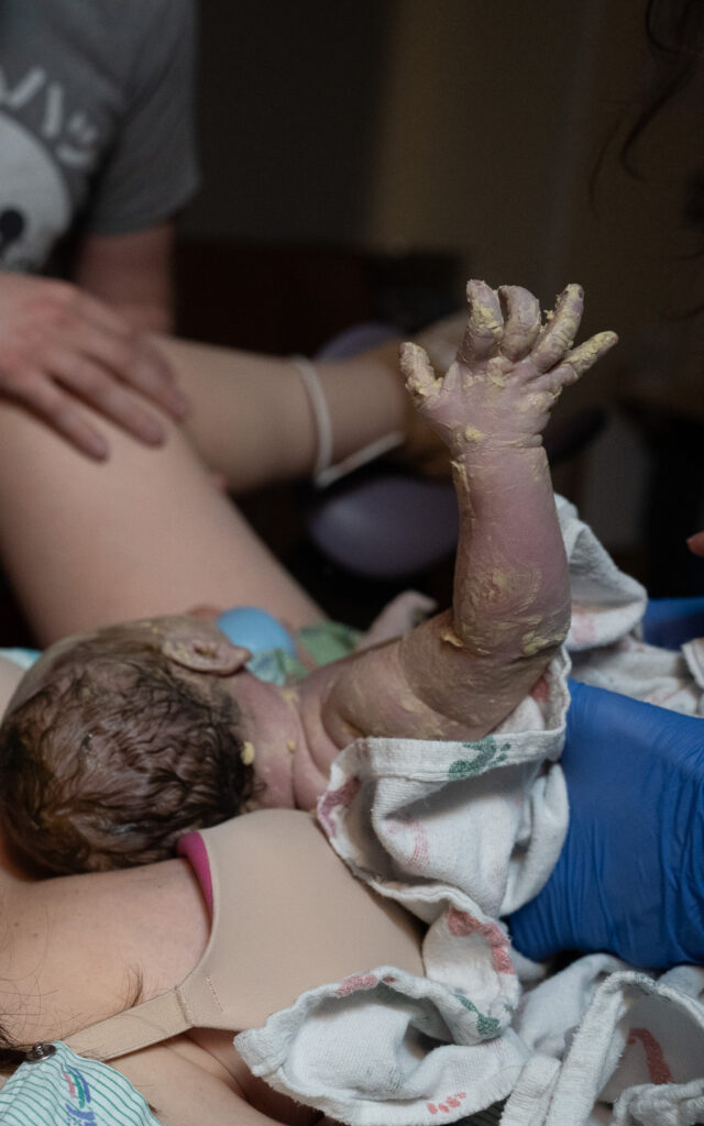 A baby holds up it's tiny arm, still needing to be wiped off after being born.