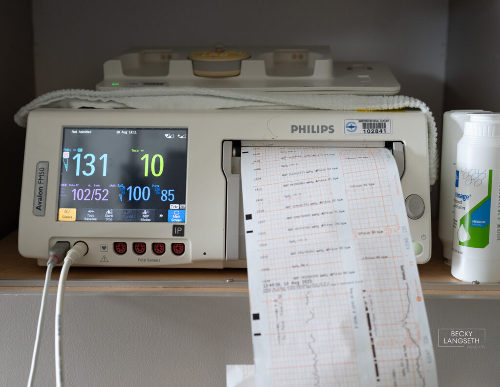 machine monitoring contractions at Swedish First Hill Birth Center